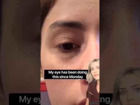 Doctor explains: random eye twitching