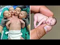 Download Lagu 18 vreemdste baby's waarvan je niet zult geloven dat ze echt bestaan