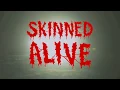 Download Lagu ENFORCED - SKINNED ALIVE (OFFICIAL VIDEO)