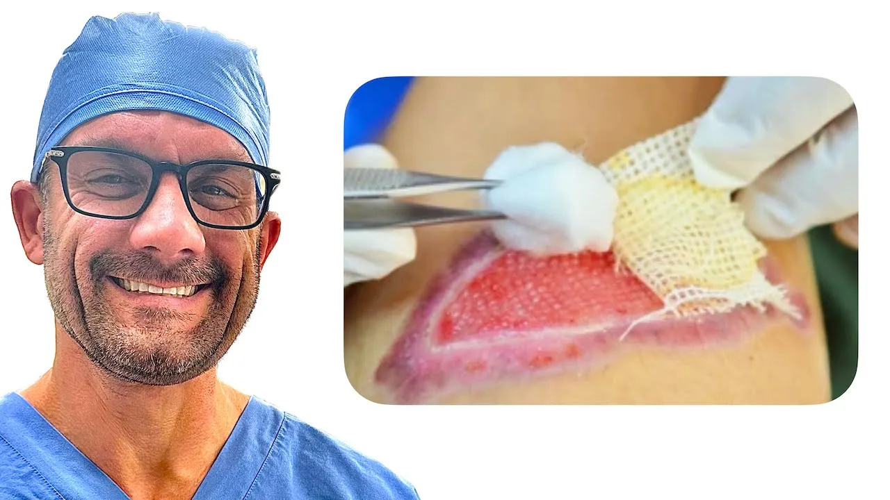 How Surgeons Clean Wounds