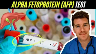 Doctor explains Alpha Fetoprotein AFP blood test Liver and testicular cancer