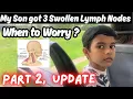 Lymph Nodes behind ear Swollen Lymph Nodes behind ear Lump Behind Ear Lump Behind Ear on bone