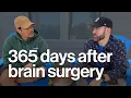 365 Days After Brain Surgery ly Diagnosed with VHL Von Hippel-Lindau
