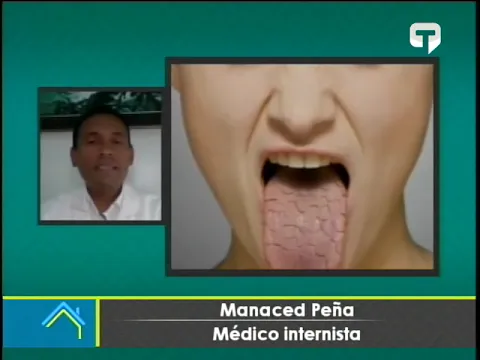 Thalía confesó que padece de Disgeusia ¿Qué es ese rato trastorno?