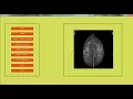 Digital Image Processing Projects List Digital Image Processing Thesis List