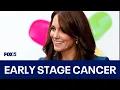 What kind of cancer does Kate have Doctor says likely Stage 1