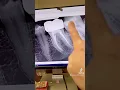A bad taste odor coming from the tooth