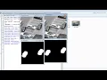 Copy Move Forgery Detection with Quad tree Decomposition Segmentation