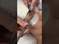 Eyelash Extension Patch Test
