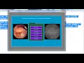 matlab mini projects image processing matlab mini thesis image processing