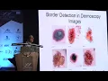 Density based Clustering Dbscan and Optics