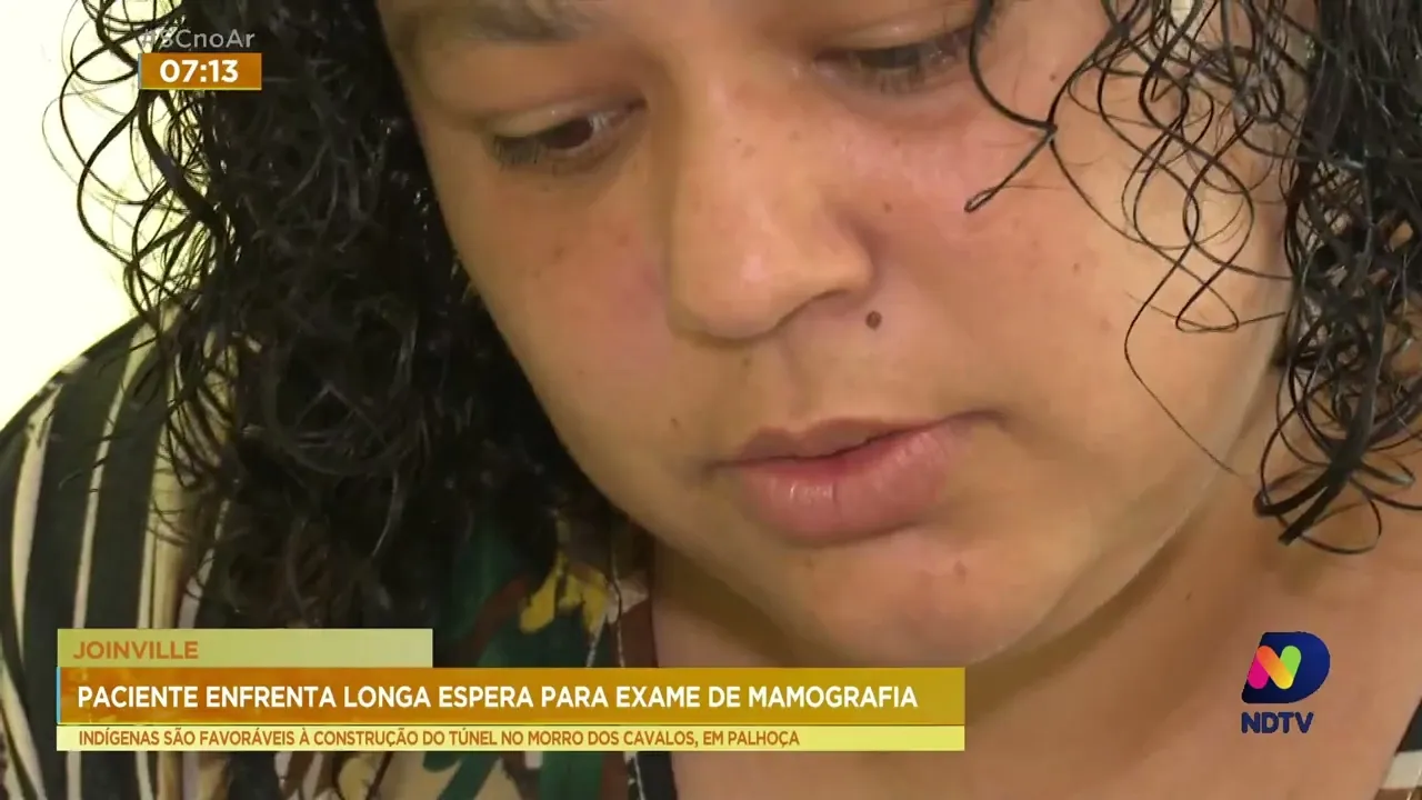 Fila de espera para exame de mamografia diminuiu nos últimos meses