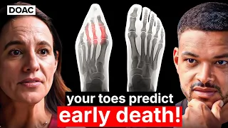 The Foot Expert Your Toes Can Predict If You ll Die Early This Will Fix Plantar Fasciitis