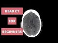 How to Read a Head CT - Radiology Approach