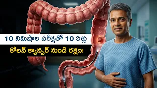 కొలనోస్కోపీ ఎవరికి అవసరం, ఎందుకు? | డా. గోపి శ్రీకాంత్