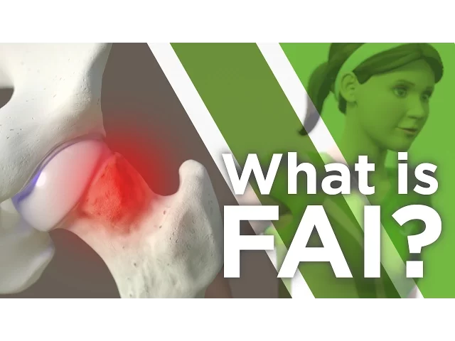 What is FAI?