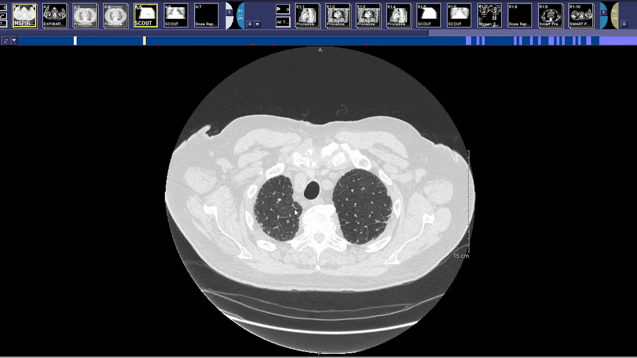 How to read a high-resolution chest CT