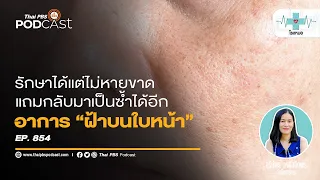 ควรทำอย่างไรเมื่อพบว่าฝ้าเริ่มกลับมาอีก