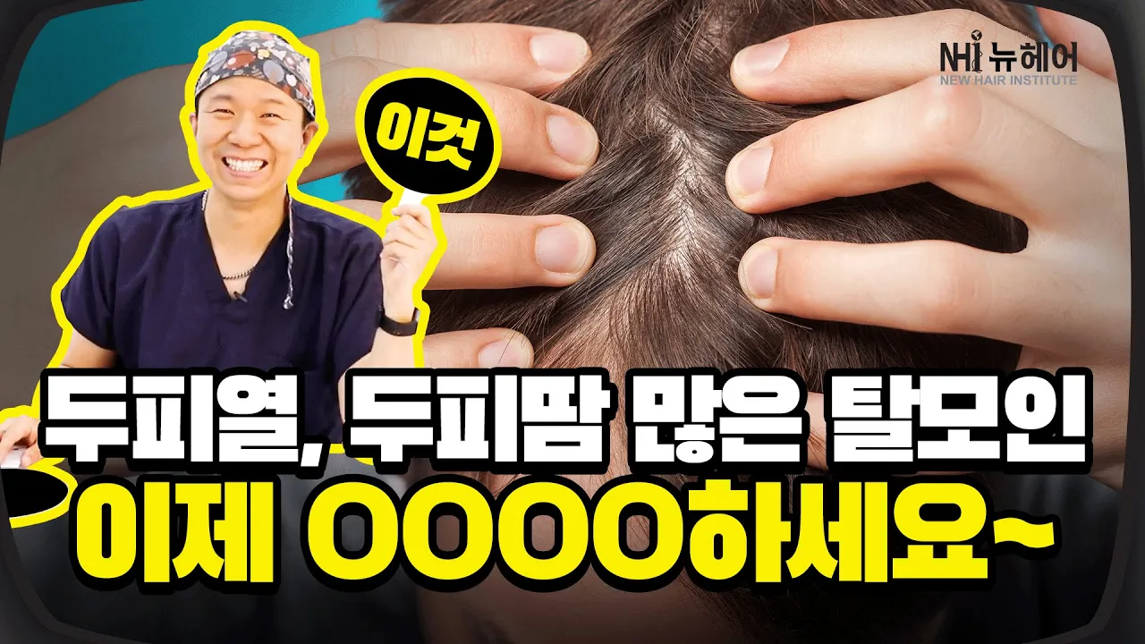 두피열, 두피땀 많은 탈모인 스프레이만 답이 아니다? - 뉴헤어 I [두피문신][헤어라인]