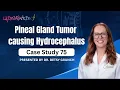 Case study 75 Pineal Gland Tumor causing Hydrocephalus Presented by Dr Betsy Grunch