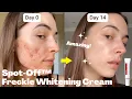 Spot-Off Freckle Whitening \u0026 Removal Cream | Dayiala.com