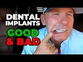 The GOOD and BAD Of My Dental Implants After 2 Years