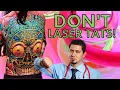 Download Lagu Why Laser Tattoo Removal Can Ruin Your Life : A Doctor Explains