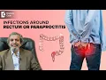 Know why you get Infections around Anus Paraproctitis - Dr Rajasekhar M R Doctors Circle
