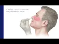SARS-CoV-2 Clinician Collected Nasal Specimen Collection Guide