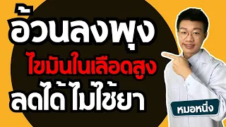 ค่า HDL ต่ำบ่งบอกถึงสุขภาพอย่างไร และจะเพิ่มค่า HDL ได้อย่างไร