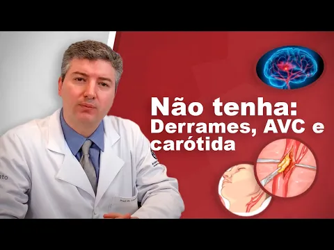 Download MP3 Derrames e a artéria carótida: Dr Alexandre Amato