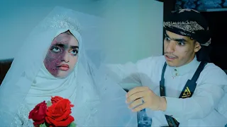 احترقت قبل زفافها بشهرين فيلم جمال الروح مؤثر 2025 