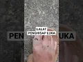 Download Lagu LALAT PENGHISAP LUKA ( SAAT DI RUANG TERBUKA )
