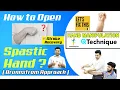 HAND MANIPULATION TECHNIQUE TO FACILITATE FINGER EXTENSION RELEASING IN PATIENTS