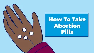 How to Take Abortion Pills Planned Parenthood