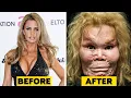 Download Lagu 20 Celebrity Plastic Surgery Disasters