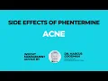 Can Phentermine Cause Acne Facts About Breakouts Relief