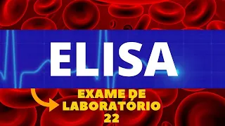 TESTE DE ELISA (EXAME DE ELISA) - IMUNOLOGIA-  PASSO A PASSO - EXAMES DE LABORATÓRIO