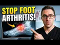 Rheumatoid Arthritis Symptoms Stages Treatment Options for Foot Pain