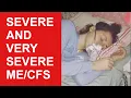Severe and Very Severe Myalgic Fatigue Syndrome