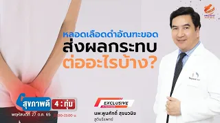 การรักษาหลอดเลือดดำอัณฑะคอร์ดทำอย่างไร