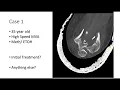 Download Lagu Multi-Institution Upper Extremity Trauma Case Discussion