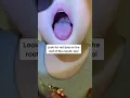 How to tell if your kid might have strep throat