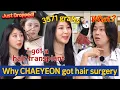 Download Lagu The reason behind LEE CHAEYEON's hair transplant surgery (hint: WATERBOMB) 😅