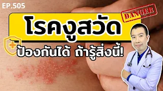 โรคงูสวัสดิ์เกิดจากเชื้อไวรัสตัวไหน และมีอาการอย่างไรบ้าง