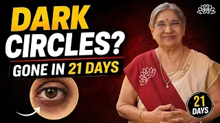 Dark Circles Gone in 21 Days | Ayurvedic Remedy + Face Yoga | Dr. Hansaji
