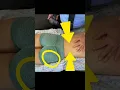 What Do U See Assesment Sport Medicine