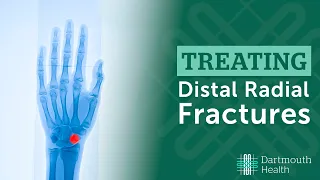 Download Treating Distal Radius Fractures at Dartmouth Health MP3