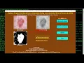 Python Code for Skin Disease Detection Using CNN Convolutional Neural Network CNN With Source Code