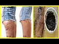 How To Get Rid Of Cellulite Naturally  In 3 days|  For Cellulite On Thighs, Stomach \u0026 Arms